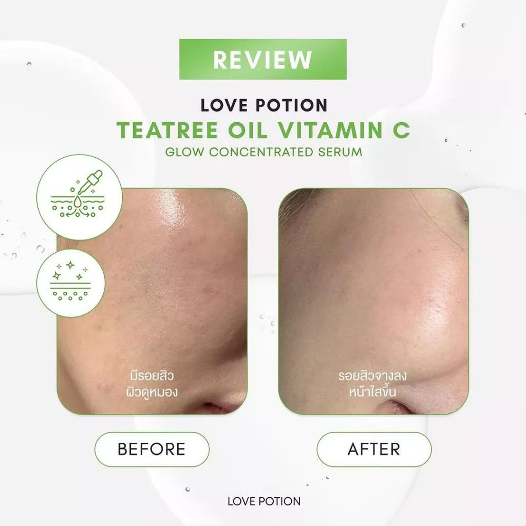 LOVE POTION TEATREE OIL VITAMIN C GLOW SERUM
