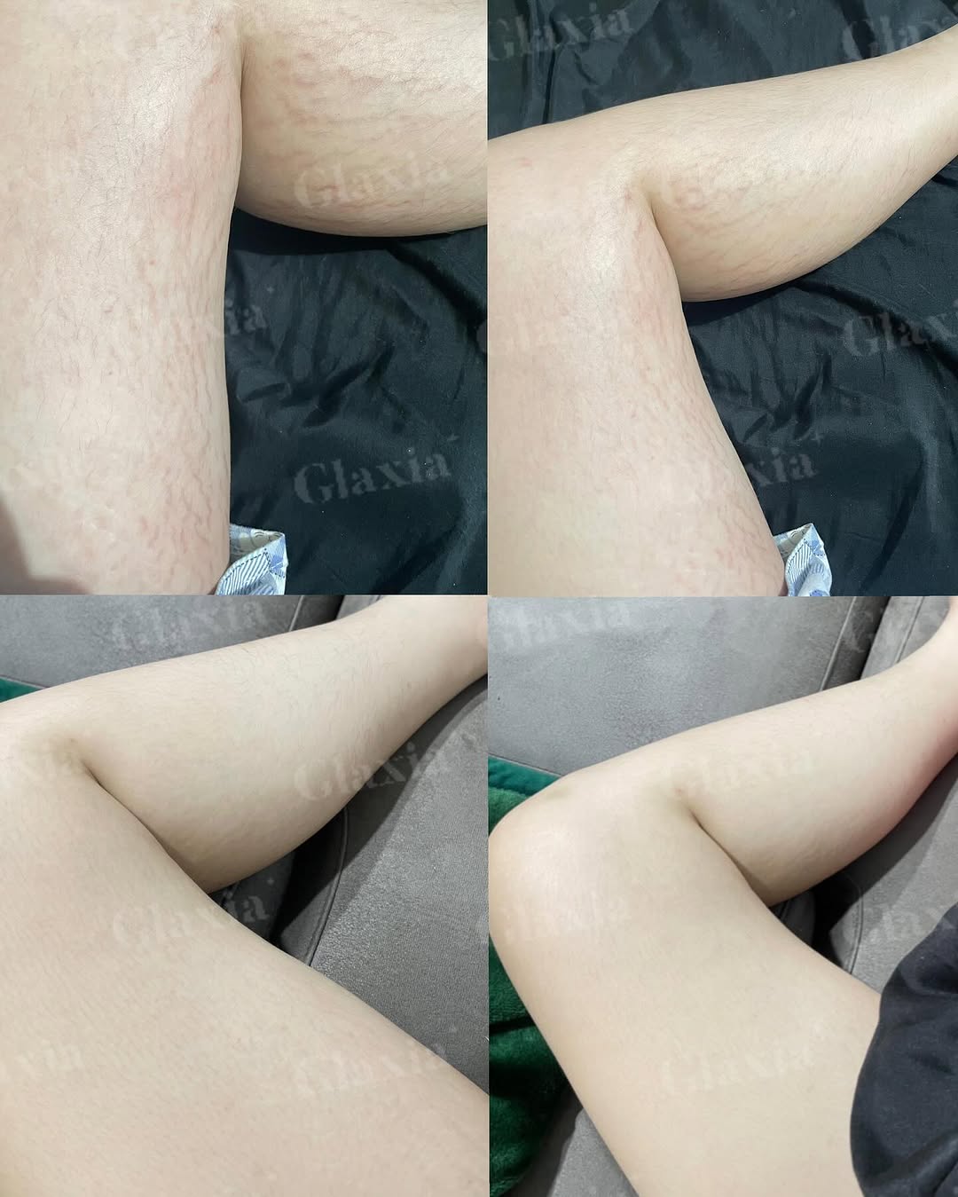 GLAXIA - GLOSSY GLOW CREAM