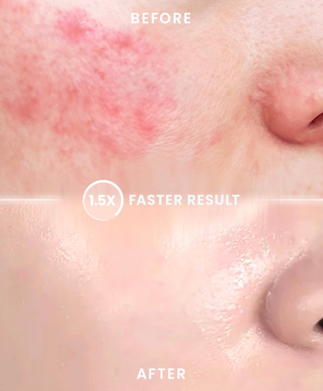 YOU- BARRIER SHIELD INTENSIVE CALMING 3% NEOBARRIX