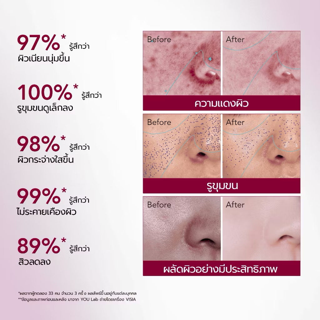 YOU - 12% ACID INTENSIVE PEELING SERUM