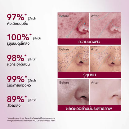 YOU - 12% ACID INTENSIVE PEELING SERUM